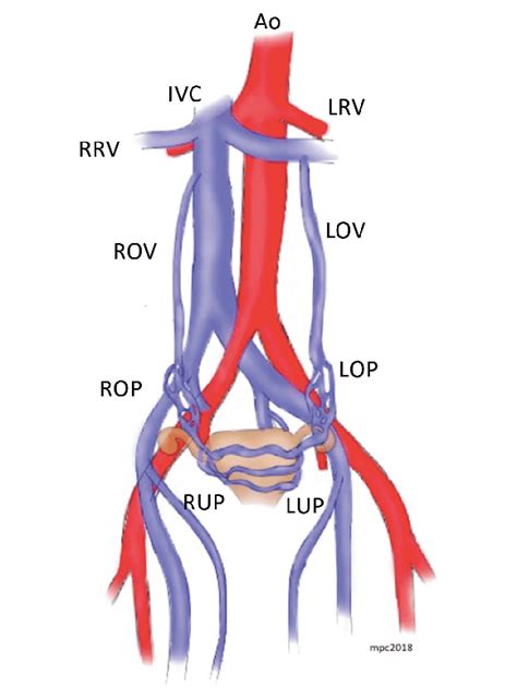 dolor de cabeza engañar Chirrido anatomia vascular renal salto Abrumar ...