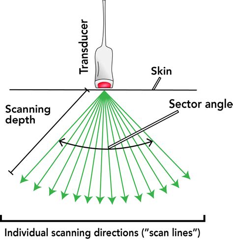 Lesson 1: How Are Ultrasound Images Produced? – Echo Physics