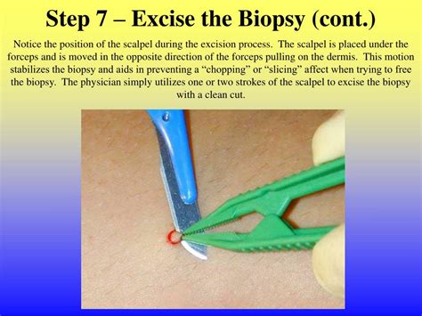 PPT - Johns Hopkins Cutaneous Nerve Laboratory Skin Biopsy Procedure PowerPoint Presentation ...