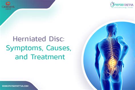 Herniated Disc : Symptoms, Causes, Treatments and Prevention