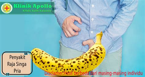 Penanganan Penyakit Raja Singa Pria di Klinik | Klinik Apollo Jakarta