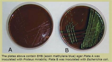 Eosin methylene blue agar (EMB) | Medical Laboratories