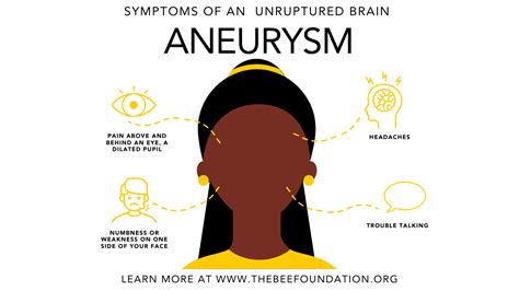 What are the symptoms of an unruptured aneurysm_ - The Bee Foundation