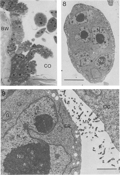 Nicolea zostericola. 7: Type II amoebocytes proliferating from parietal... | Download Scientific ...