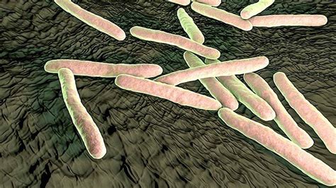 What Are Mycobacterium Avium Complex Infections? Causes, Treatment, Prevention, and More ...