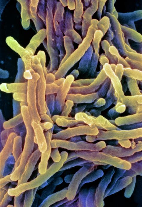 Tuberculosis Bacteria Photograph by Science Photo Library - Pixels