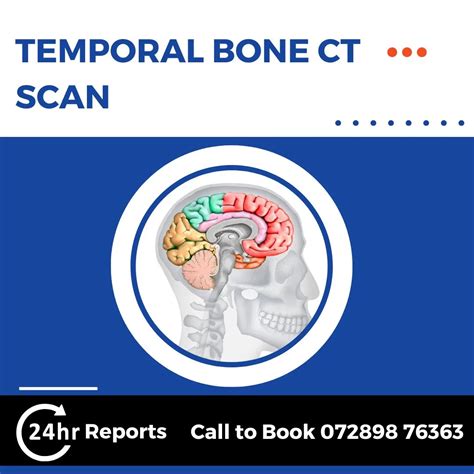 Temporal Bone CT Scan @ Rs 1600 | Call 7289876363