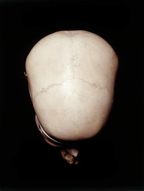 Female Human Skull Photograph by Dorling Kindersley/uig - Fine Art America