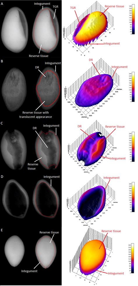 Images from the X-ray tests of the seeds of Enterolobium... | Download Scientific Diagram