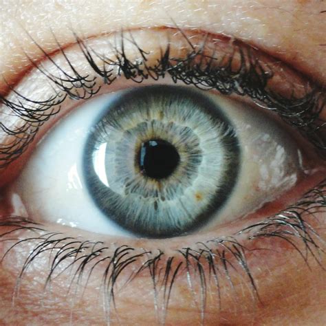 Changes In Eye Color May Signal Health Problems | Off The Press