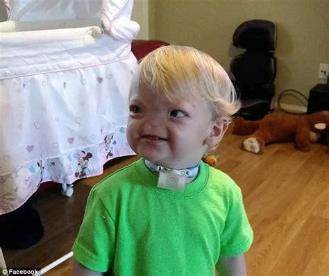 Tragic Update For Baby Born Without A Nose (Photos) - Relay Hero