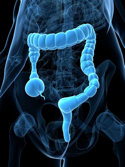 Colonic Spasm Photograph by Sciepro/science Photo Library - Fine Art America