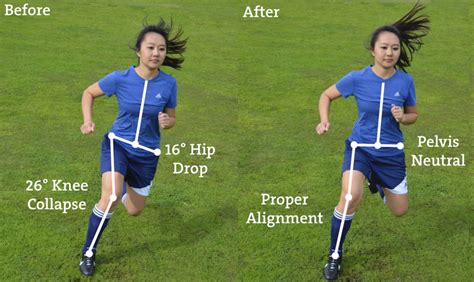 Who Needs Knees? Why ACL injury prevention matters - Stride Physio