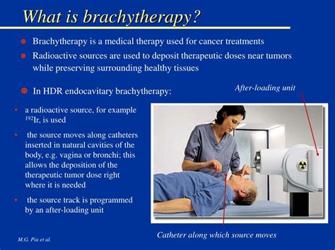 PPT - Brachytherapy at IST Results from an atypical Comparison Project ...