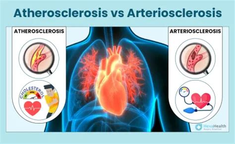 Atherosclerosis vs Arteriosclerosis: Understand the Difference