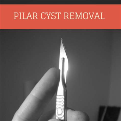 The Drs: Pilar Cyst Removal + How To Avoid Mosquito Bites