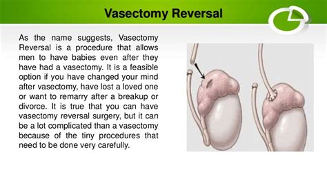 Vasectomy reversal