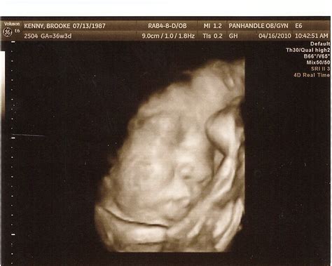 The Kenny Family: Ultrasound Pictures- 36 weeks