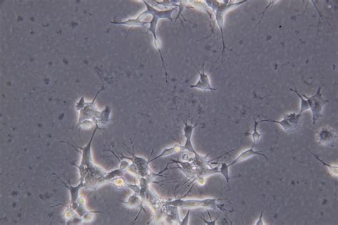 Cell contamination or debris/necrosis (black dots in SH-SY5Y cultures that do not kill the cells)?