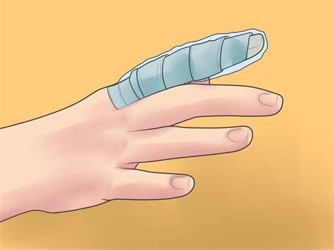 3 Ways to Splint a Finger - wikiHow