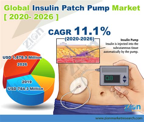 Insulin Patch Pump Market Size, Industry Share, Report 2032