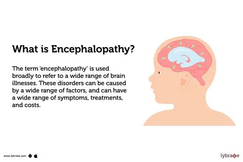 Encephalopathy: Treatment, Procedure, Cost, Recovery, Side Effects And More