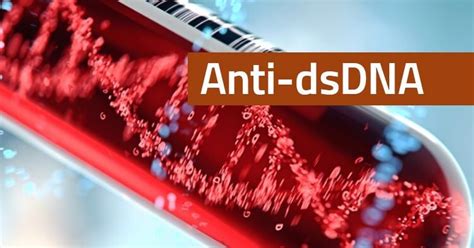 Anti-dsDNA laboratory test: What is it? – Open Source Biology ...