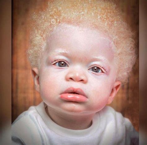 Pin by C.baby on Family/Children/friendship | Albino girl, Baby face, Beautiful babies