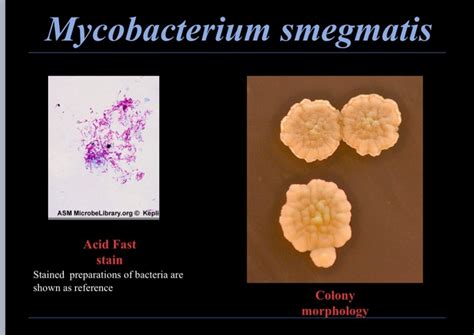 Solved Bacterial Morphology and Colony Morphology Report | Chegg.com