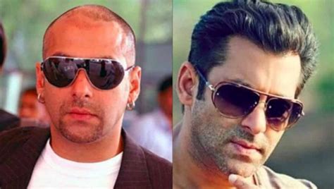 Bollywood Actors Hair Transplant Before and After Images - TrendingWeBlog