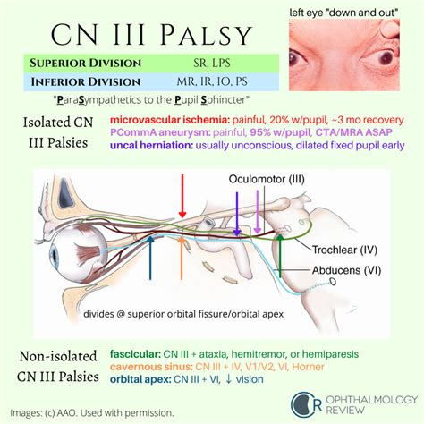 Ophthalmology Review