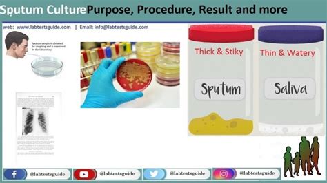 Sputum Culture - Lab Tests Guide