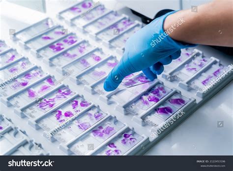 Hand Blue Glove Holding Glass Histology Stock Photo 2122453196 ...