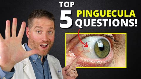 Yellow Spot On Your Eye (Pinguecula) - Top 5 Questions Answered! - YouTube