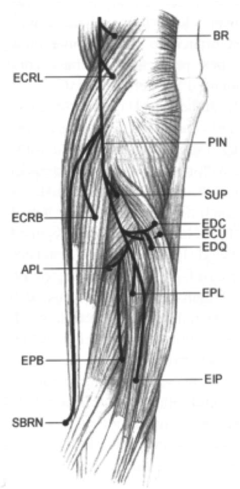 Radial nerve - Anatomy - Orthobullets
