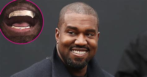 Kanye West Gets Titanium Grill That Cost $850K | Us Weekly