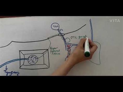 Otic Ganglion Full Anatomy Described for easy understanding - YouTube