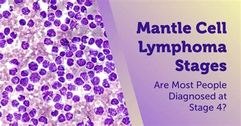 Mantle Cell Lymphoma Stages: Are Most People Diagnosed at Stage 4? | MyLymphomaTeam