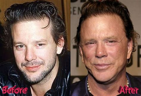 Mickey Rourke Plastic Surgery: Is It Enough?