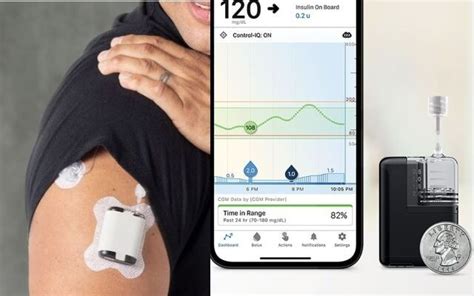 Automated Insulin Delivery Wearables : Tandem Mobi - JanPost