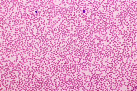 Red Blood Cells in Blood Smear Stock Photo - Image of hematopoiesis, count: 217903192