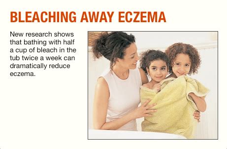 Bleach Baths for Eczema Treatment Prove Effective - Allergic Living