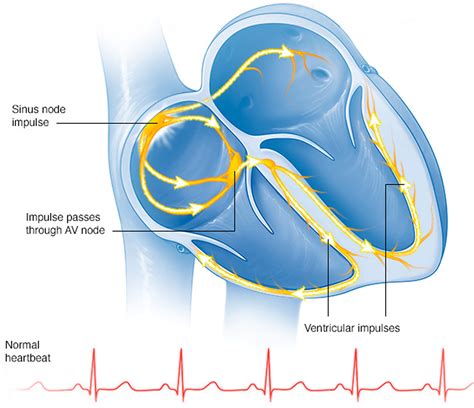 Sick Sinus Syndrome - Causes, Symptoms, ECG, Treatment