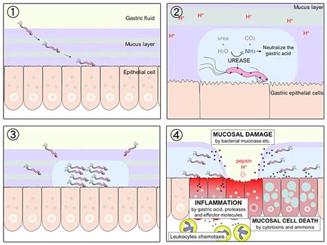 H. Pylori Transmission and Spread of Infection | Mel and Enid Zuckerman College of Public Health