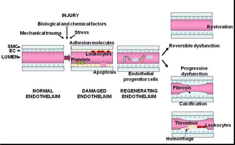 Endothelial injury and repair outcome. Physiological and life style... | Download Scientific Diagram