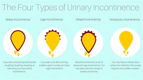 ThermiVA for Incontinence - Walnut Hill