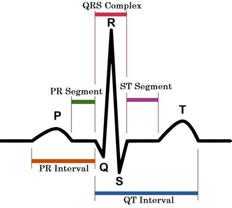 Image of one complete ECG waveform | Download Scientific Diagram