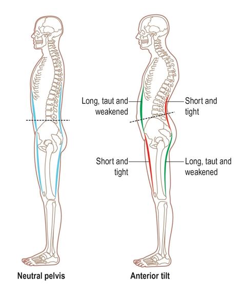 Tight Hamstrings? Part 1 - InBox Rehab