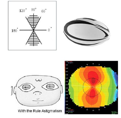 How to find Type of Astigmatism through Prescription?