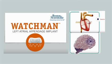 What is WATCHMAN LAA Device Closure? - The Heart & Vascular Centre